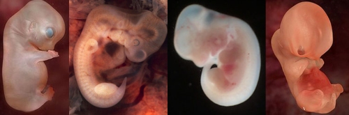 Uno de ellos es un embrión humano de 7 semanas